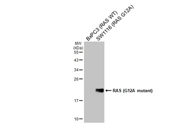 Anti-RAS (G12A mutant) antibody [HL1153] used in Western Blot (WB). GTX636434