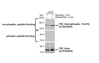 Anti-PKC theta (phospho Thr219) antibody [HL1157] used in Western Blot (WB). GTX636461