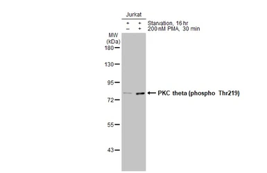 Anti-PKC theta (phospho Thr219) antibody [HL1157] used in Western Blot (WB). GTX636461