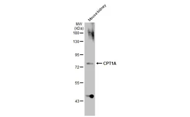 Anti-CPT1A antibody [HL1164] used in Western Blot (WB). GTX636468