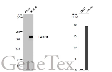 Anti-PARP14 antibody [HL1178] used in Western Blot (WB). GTX636483