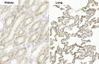 Anti-PARP14 antibody [HL1180] used in IHC (Paraffin sections) (IHC-P). GTX636485