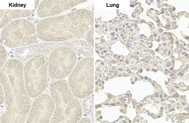 Anti-PARP14 antibody [HL1180] used in IHC (Paraffin sections) (IHC-P). GTX636485