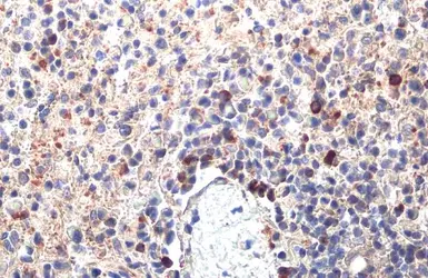 Anti-PARP14 antibody [HL1180] used in IHC (Paraffin sections) (IHC-P). GTX636485