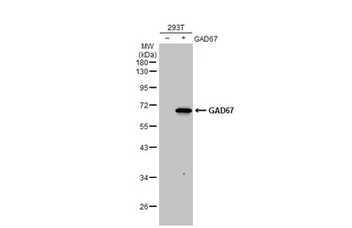 Anti-GAD65 + GAD67 antibody [HL1181] used in Western Blot (WB). GTX636487