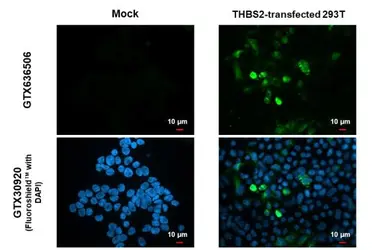 Anti-Thrombospondin 2 antibody [HL1194] used in Immunocytochemistry/ Immunofluorescence (ICC/IF). GTX636506