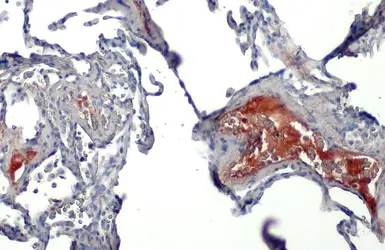 Anti-C1 inhibitor antibody [HL1196] used in IHC (Paraffin sections) (IHC-P). GTX636508
