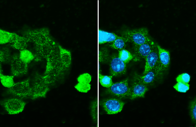 Anti-C1 inhibitor antibody [HL1196] used in Immunocytochemistry/ Immunofluorescence (ICC/IF). GTX636508