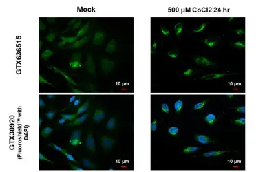 Anti-BNIP3L antibody [HL1203] used in Immunocytochemistry/ Immunofluorescence (ICC/IF). GTX636515