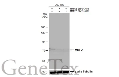 Anti-MMP2 antibody [HL1207] used in Western Blot (WB). GTX636524