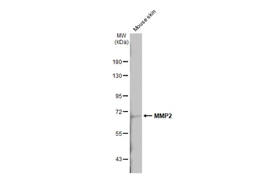 Anti-MMP2 antibody [HL1207] used in Western Blot (WB). GTX636524
