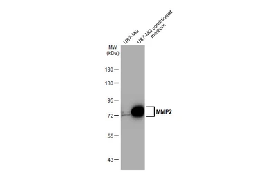Anti-MMP2 antibody [HL1208] used in Western Blot (WB). GTX636525