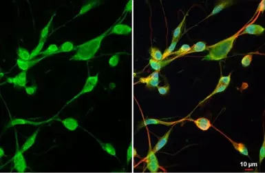 Anti-MMP2 antibody [HL1208] used in Immunocytochemistry/ Immunofluorescence (ICC/IF). GTX636525