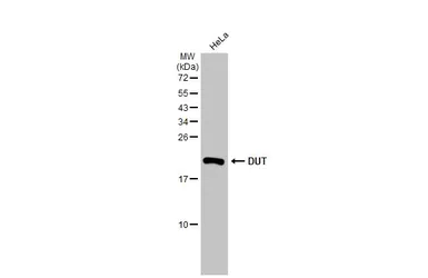 Anti-DUT antibody [HL1210] used in Western Blot (WB). GTX636527