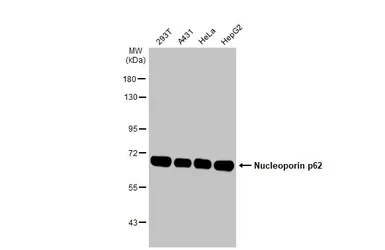 Anti-Nucleoporin p62 antibody [HL1226] used in Western Blot (WB). GTX636570