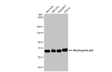 Anti-Nucleoporin p62 antibody [HL1226] used in Western Blot (WB). GTX636570