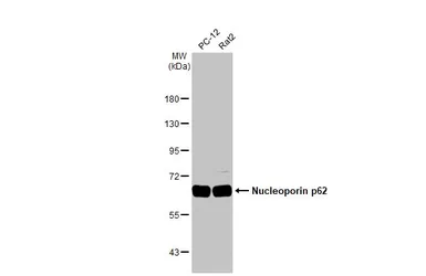 Anti-Nucleoporin p62 antibody [HL1226] used in Western Blot (WB). GTX636570