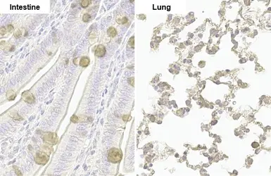 Anti-Nucleoporin p62 antibody [HL1226] used in IHC (Paraffin sections) (IHC-P). GTX636570