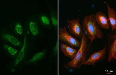 Anti-IL6 antibody [GT1535] used in Immunocytochemistry/ Immunofluorescence (ICC/IF). GTX636571