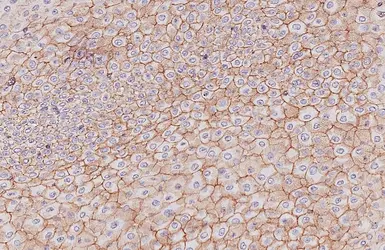 Anti-E-Cadherin antibody [HL1228] used in IHC (Paraffin sections) (IHC-P). GTX636576