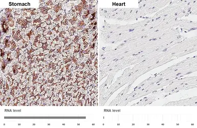 Anti-E-Cadherin antibody [HL1228] used in IHC (Paraffin sections) (IHC-P). GTX636576