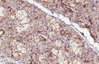 Anti-E-Cadherin antibody [HL1228] used in IHC (Paraffin sections) (IHC-P). GTX636576