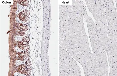 Anti-E-Cadherin antibody [HL1228] used in IHC (Paraffin sections) (IHC-P). GTX636576