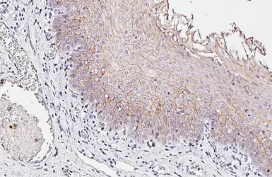 Anti-E-Cadherin antibody [HL1228] used in IHC (Paraffin sections) (IHC-P). GTX636576