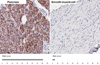 Anti-E-Cadherin antibody [HL1228] used in IHC (Paraffin sections) (IHC-P). GTX636576