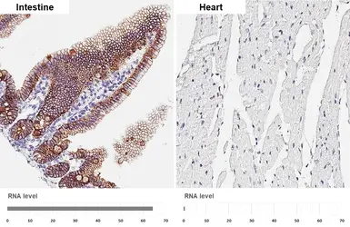 Anti-E-Cadherin antibody [HL1229] used in IHC (Paraffin sections) (IHC-P). GTX636577