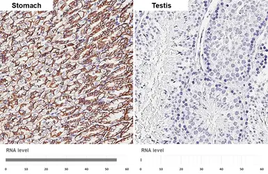 Anti-E-Cadherin antibody [HL1229] used in IHC (Paraffin sections) (IHC-P). GTX636577
