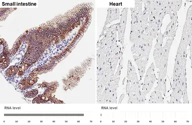 Anti-E-Cadherin antibody [HL1229] used in IHC (Paraffin sections) (IHC-P). GTX636577