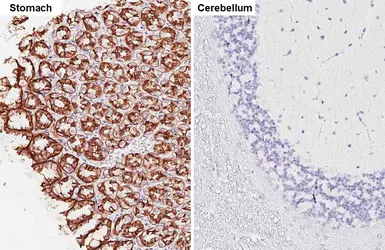 Anti-E-Cadherin antibody [HL1229] used in IHC (Paraffin sections) (IHC-P). GTX636577