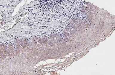 Anti-E-Cadherin antibody [HL1229] used in IHC (Paraffin sections) (IHC-P). GTX636577