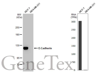 Anti-E-Cadherin antibody [HL1229] used in Western Blot (WB). GTX636577