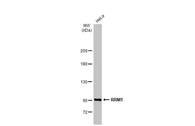 Anti-RRM1 antibody [HL1231] used in Western Blot (WB). GTX636579