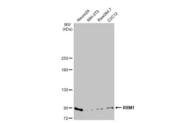 Anti-RRM1 antibody [HL1231] used in Western Blot (WB). GTX636579