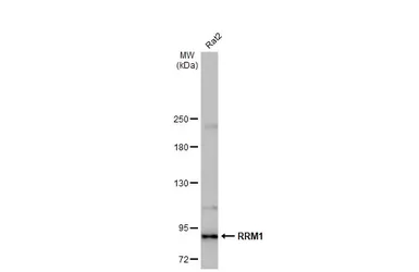 Anti-RRM1 antibody [HL1231] used in Western Blot (WB). GTX636579
