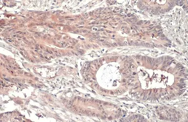 Anti-RRM1 antibody [HL1231] used in IHC (Paraffin sections) (IHC-P). GTX636579