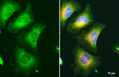 Anti-RRM1 antibody [HL1231] used in Immunocytochemistry/ Immunofluorescence (ICC/IF). GTX636579