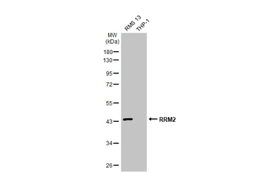 Anti-RRM2 antibody [HL1235] used in Western Blot (WB). GTX636634
