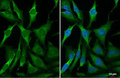 Anti-RRM2 antibody [HL1235] used in Immunocytochemistry/ Immunofluorescence (ICC/IF). GTX636634