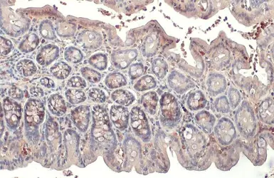 Anti-RRM2 antibody [HL1235] used in IHC (Paraffin sections) (IHC-P). GTX636634