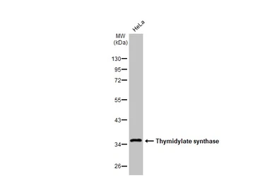 Anti-Thymidylate synthase antibody [HL1236] used in Western Blot (WB). GTX636635