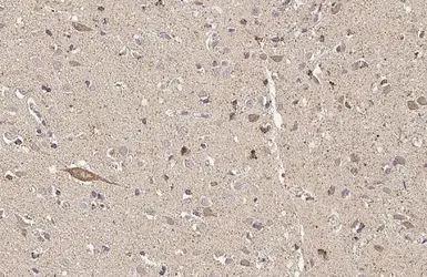 Anti-Thymidylate synthase antibody [HL1236] used in IHC (Paraffin sections) (IHC-P). GTX636635