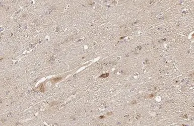 Anti-Thymidylate synthase antibody [HL1236] used in IHC (Paraffin sections) (IHC-P). GTX636635