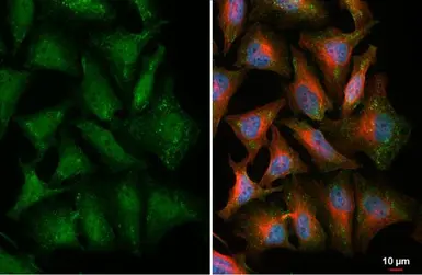 Anti-Thymidylate synthase antibody [HL1236] used in Immunocytochemistry/ Immunofluorescence (ICC/IF). GTX636635