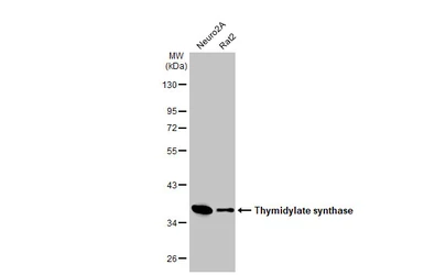 Anti-Thymidylate synthase antibody [HL1236] used in Western Blot (WB). GTX636635