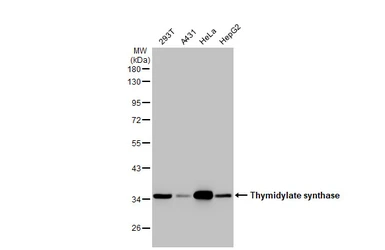 Anti-Thymidylate synthase antibody [HL1237] used in Western Blot (WB). GTX636636