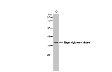 Anti-Thymidylate synthase antibody [HL1237] used in Western Blot (WB). GTX636636